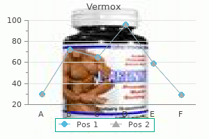 discount 100 mg vermox amex