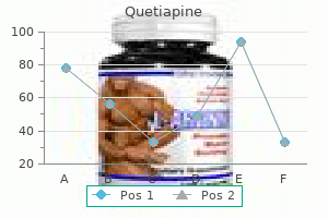 generic 50 mg quetiapine with amex